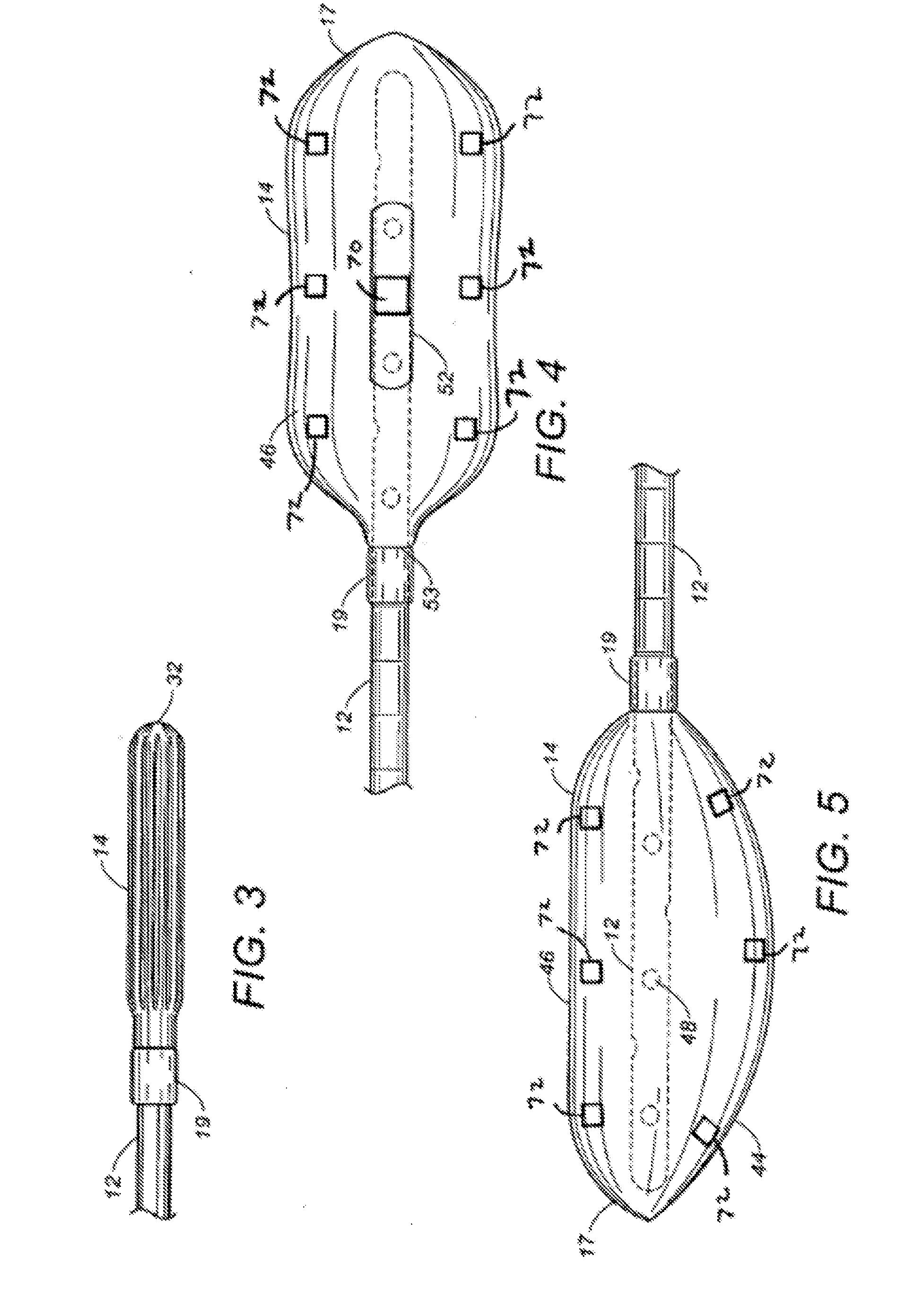 Rectal balloon with sensor cable