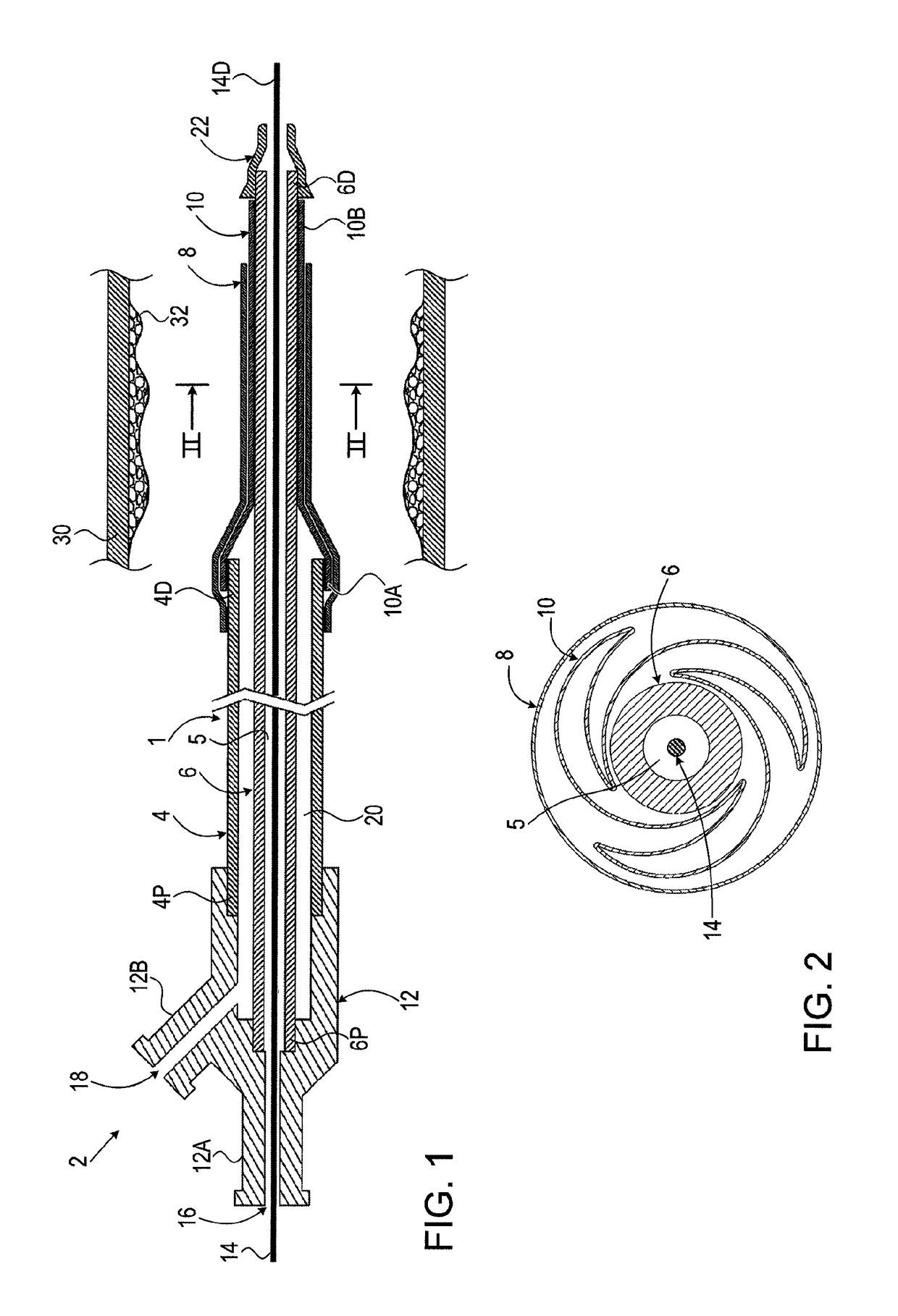 Balloon catheter and methods of use thereof