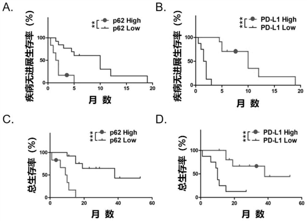 Application of p62/SQSTM1 in preparation of PD-L1/PD-1 monoclonal antibody tumor immunotherapy drug