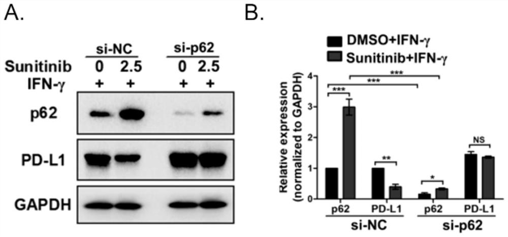 Application of p62/SQSTM1 in preparation of PD-L1/PD-1 monoclonal antibody tumor immunotherapy drug