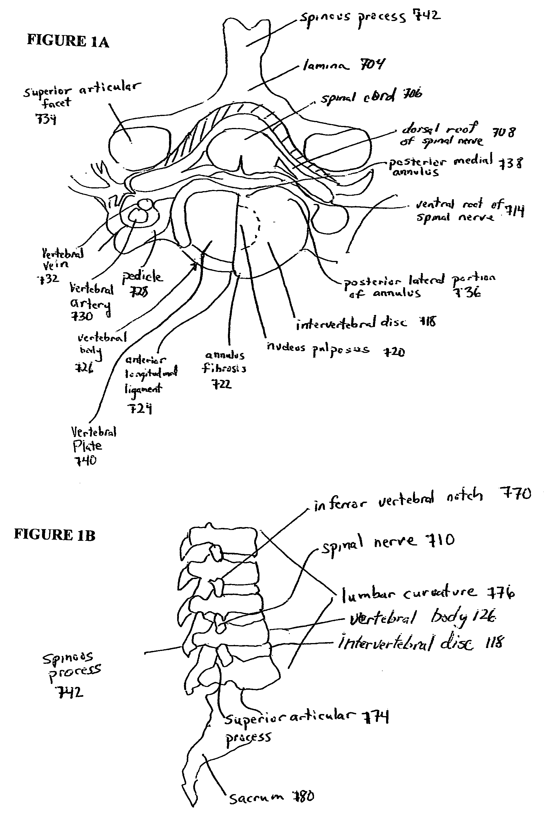 Devices and methods for spine repair