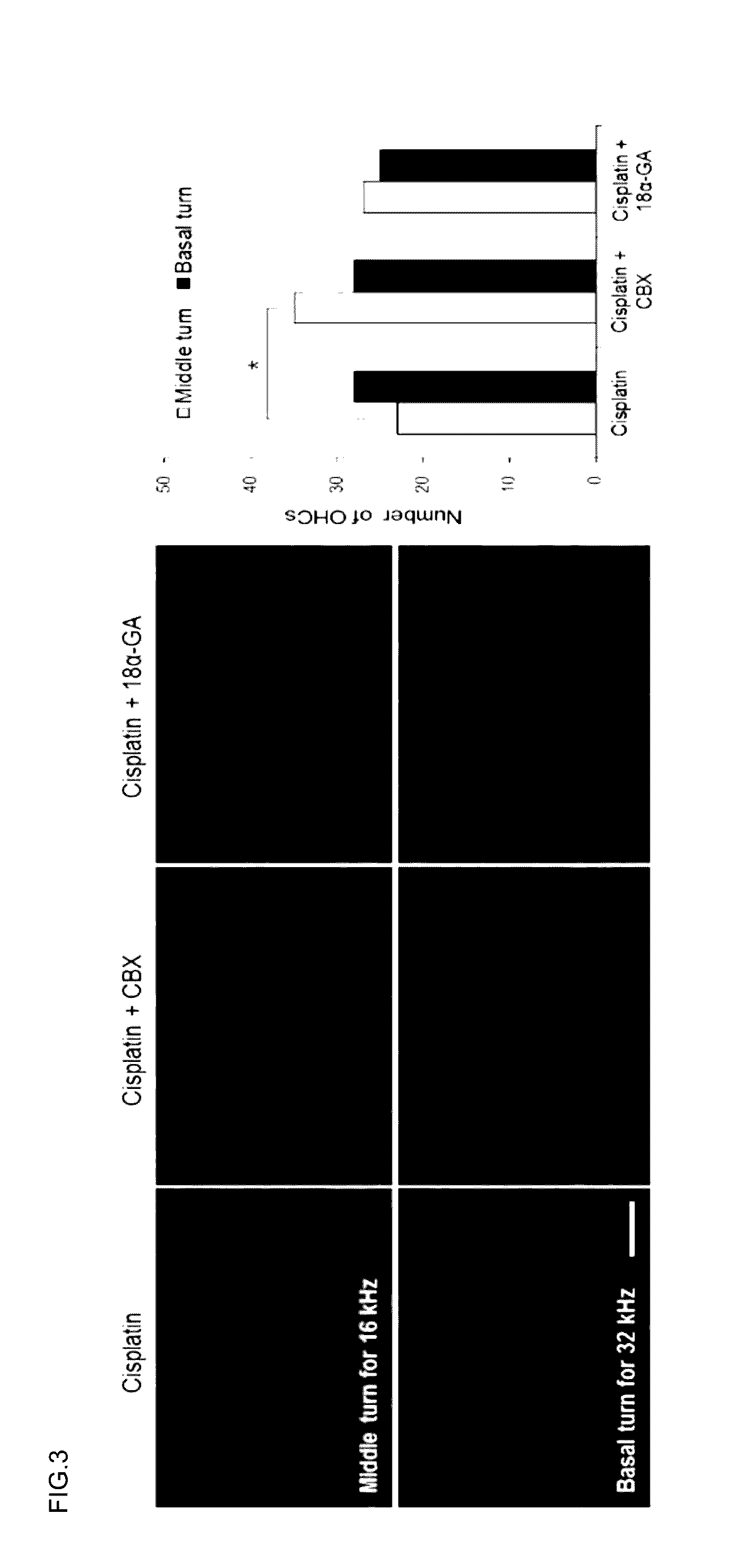 Pharmaceutical composition for preventing or treatinghearing loss, comprising carbenoxolone or its pharmaceutically acceptable salts as effective compound