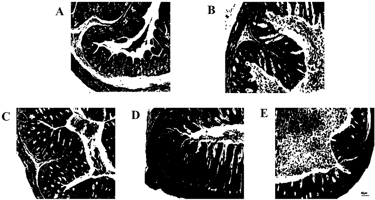 Pediococcus pentosaceus CCFM1012 as well as fermented food thereof and application thereof in preparation of medicine for antagonizing campylobacter jejuni infection