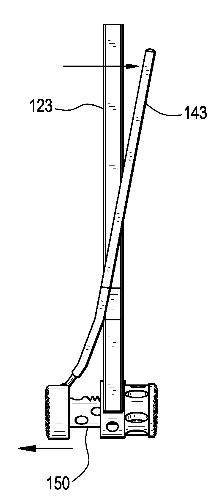 Minimally invasive corpectomy cage and instrument