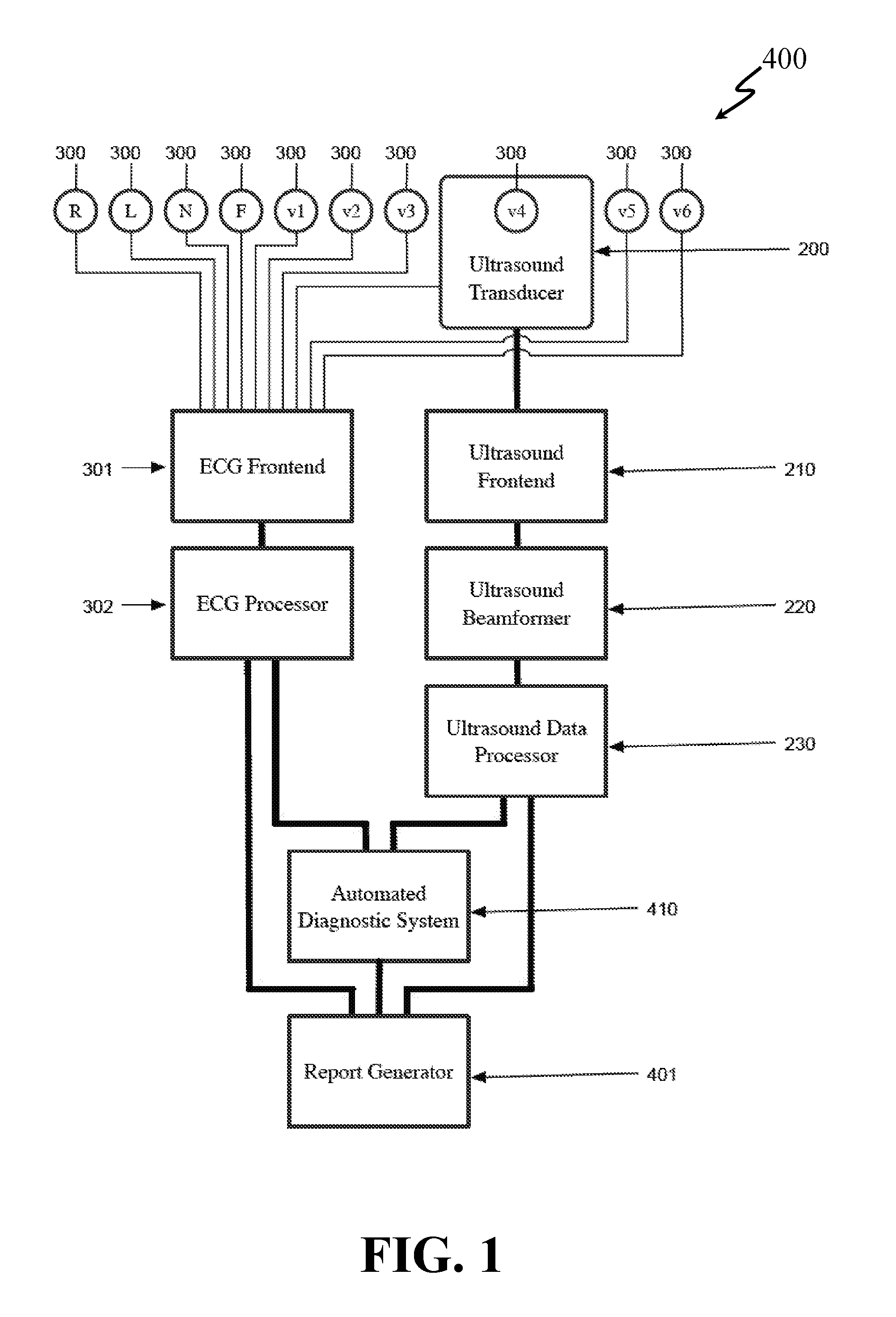 System and Method for Combined ECG-Echo for Cardiac Diagnosis