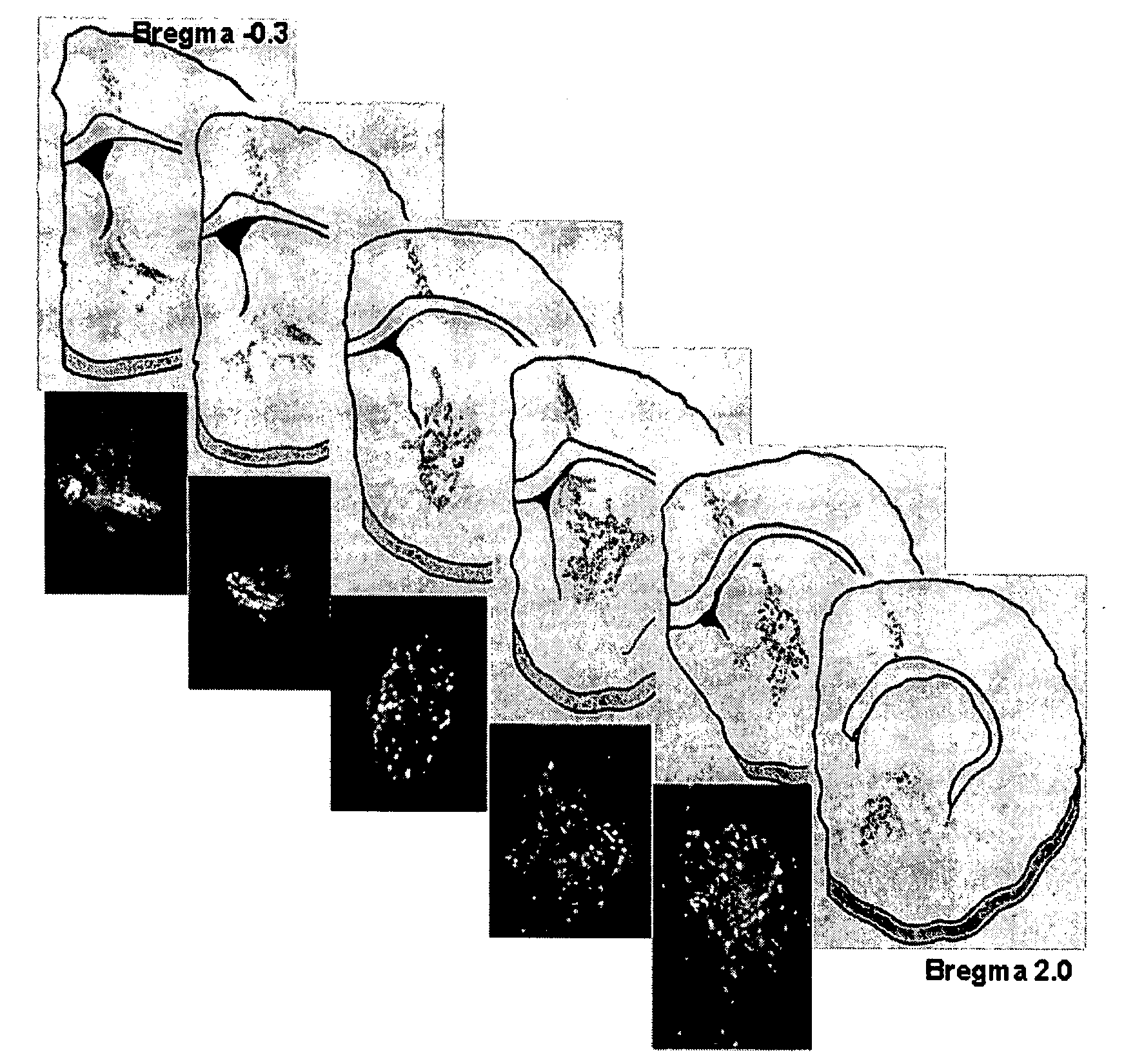 Cell system for alleviating syndromes of Parkinson's disease in a mammal