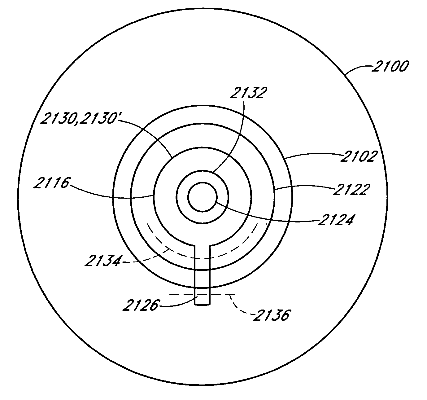 Ocular inlay with locator