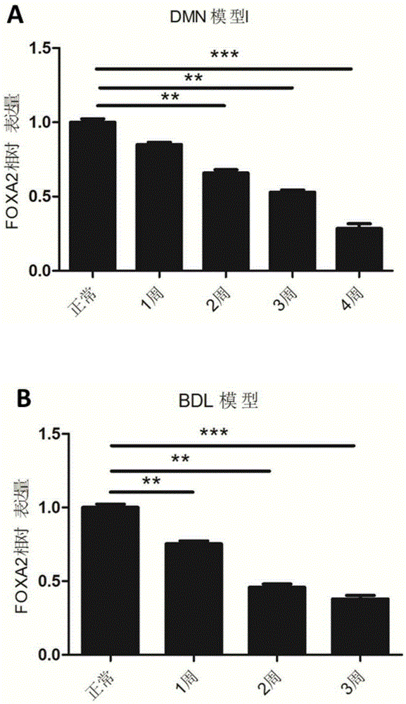 Application of box Forkhead box (FOXA2) in preparation of medicine for treating chronic liver disease