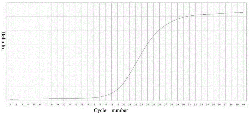 Selective medium for multiplex proliferation of salmonella, listeria monocytogenes and vibrio parahaemolyticus and preparation method of selective medium