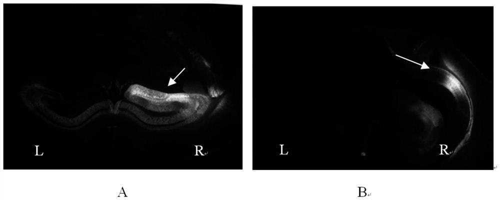 Method for accelerating protein-like propagation of tau pathology in brain of C57BL6 mouse