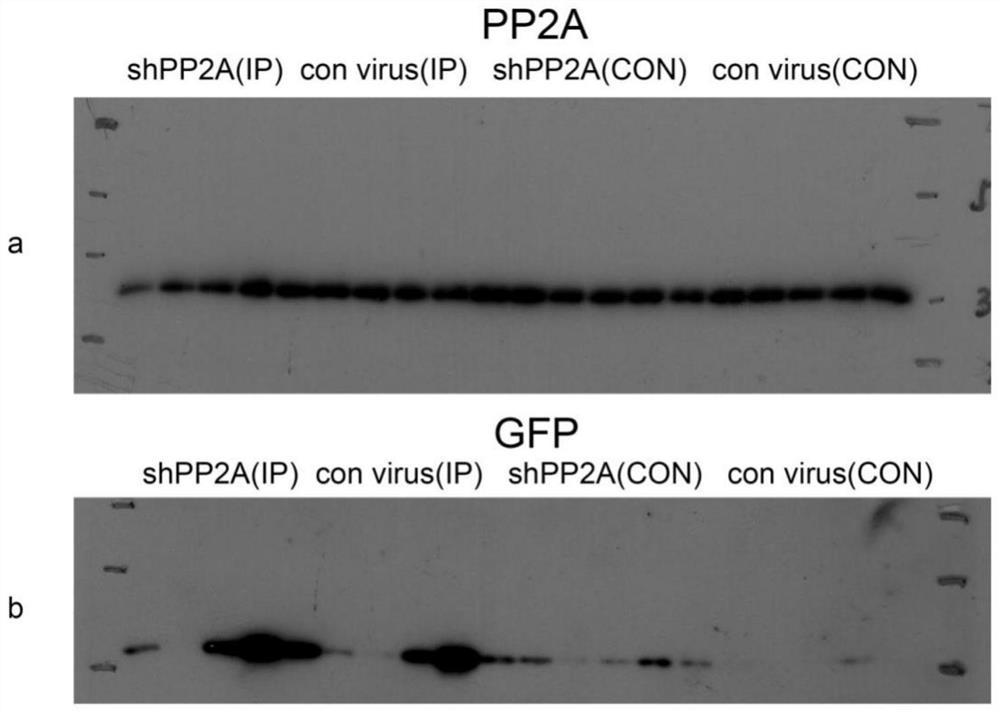 Method for accelerating protein-like propagation of tau pathology in brain of C57BL6 mouse