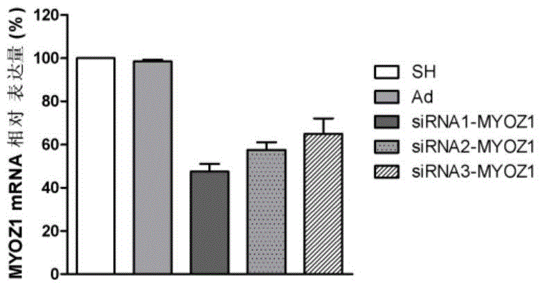 MYOZ1 gene and application of expression product of MYOZ1 gene in diagnosing and treating parkinsonism