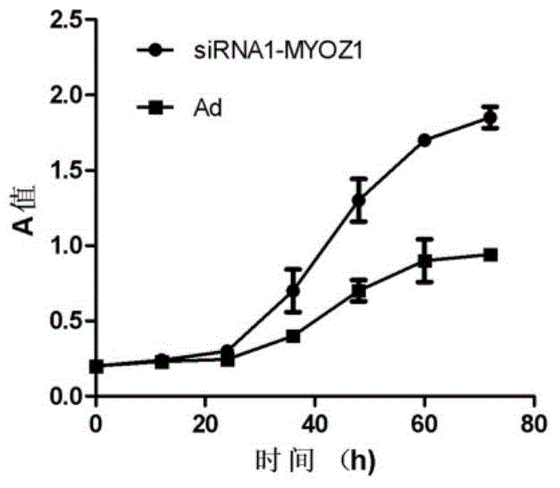 MYOZ1 gene and application of expression product of MYOZ1 gene in diagnosing and treating parkinsonism