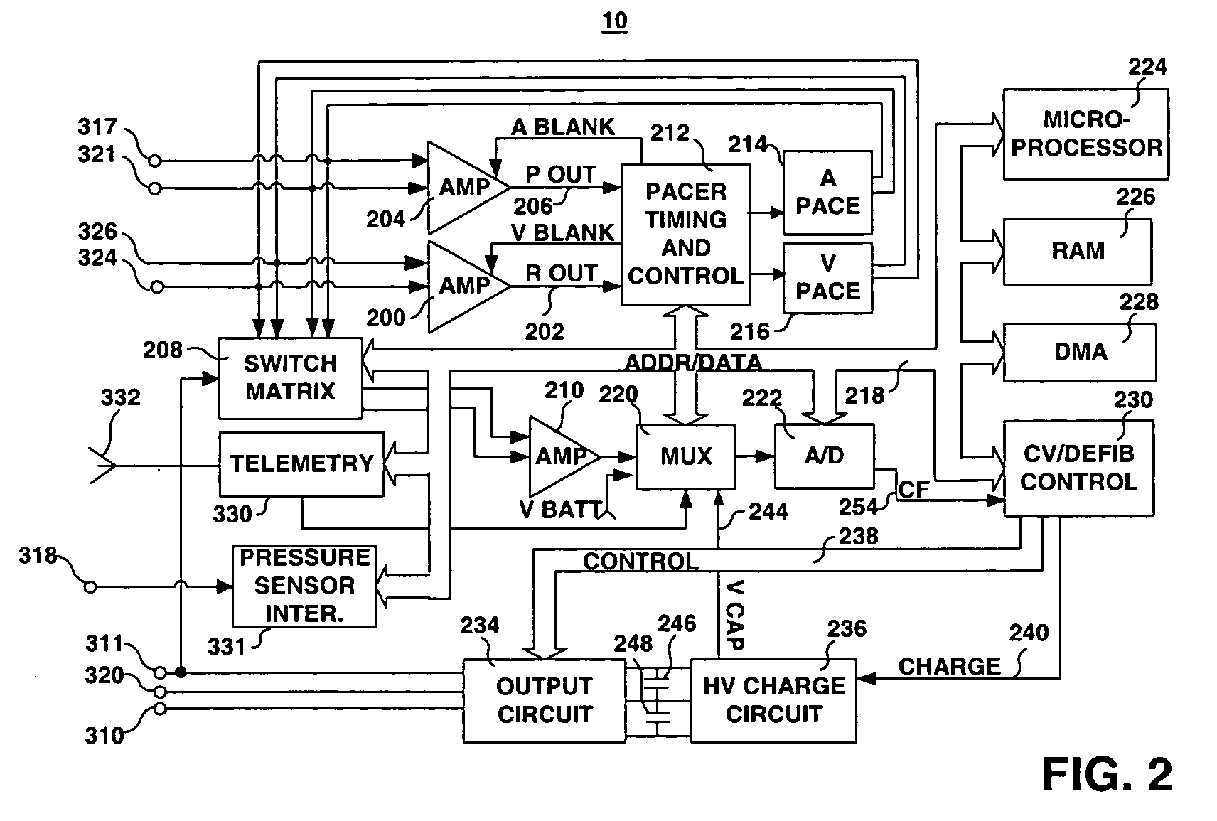 Combination of electrogram and intra-cardiac pressure to discriminate between fibrillation and tachycardia