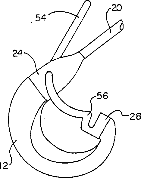 Vessel occlusive apparatus and method