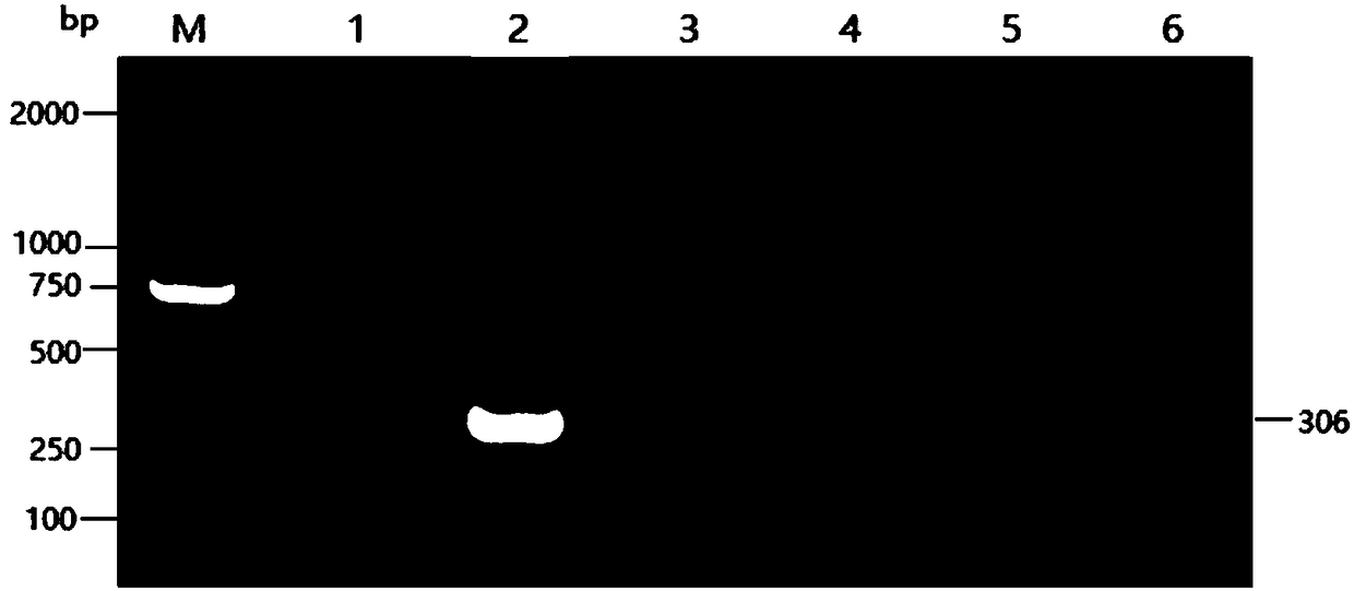 Bird polyoma virus PCR (polymerase chain reaction) diagnostic kit and detection method thereof