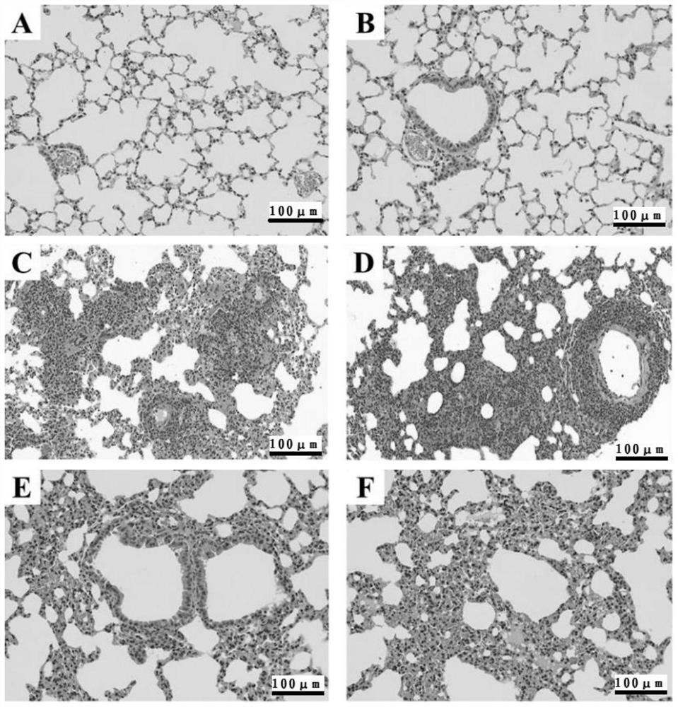 A kind of extraction method and application of Korla fragrant pear acid polysaccharide