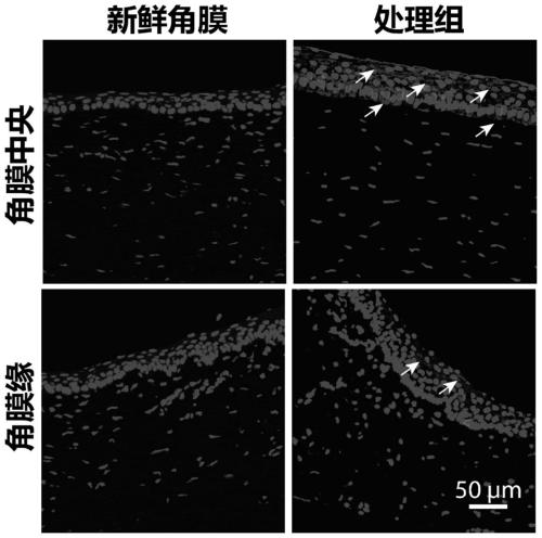 Limbal stem cells and preparation method thereof