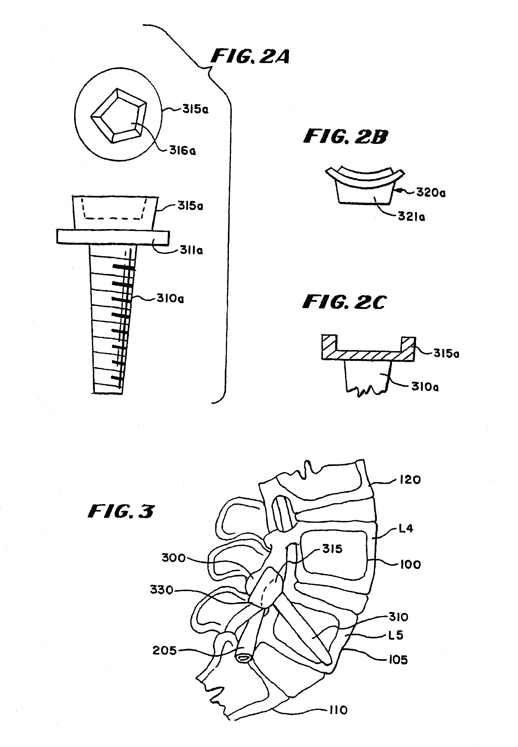 Facet arthroplasty devices and methods