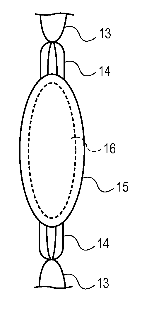 Intraocular Lenses and Methods of Accounting for Capsule Size Variability and Post-Implant Changes in the Eye