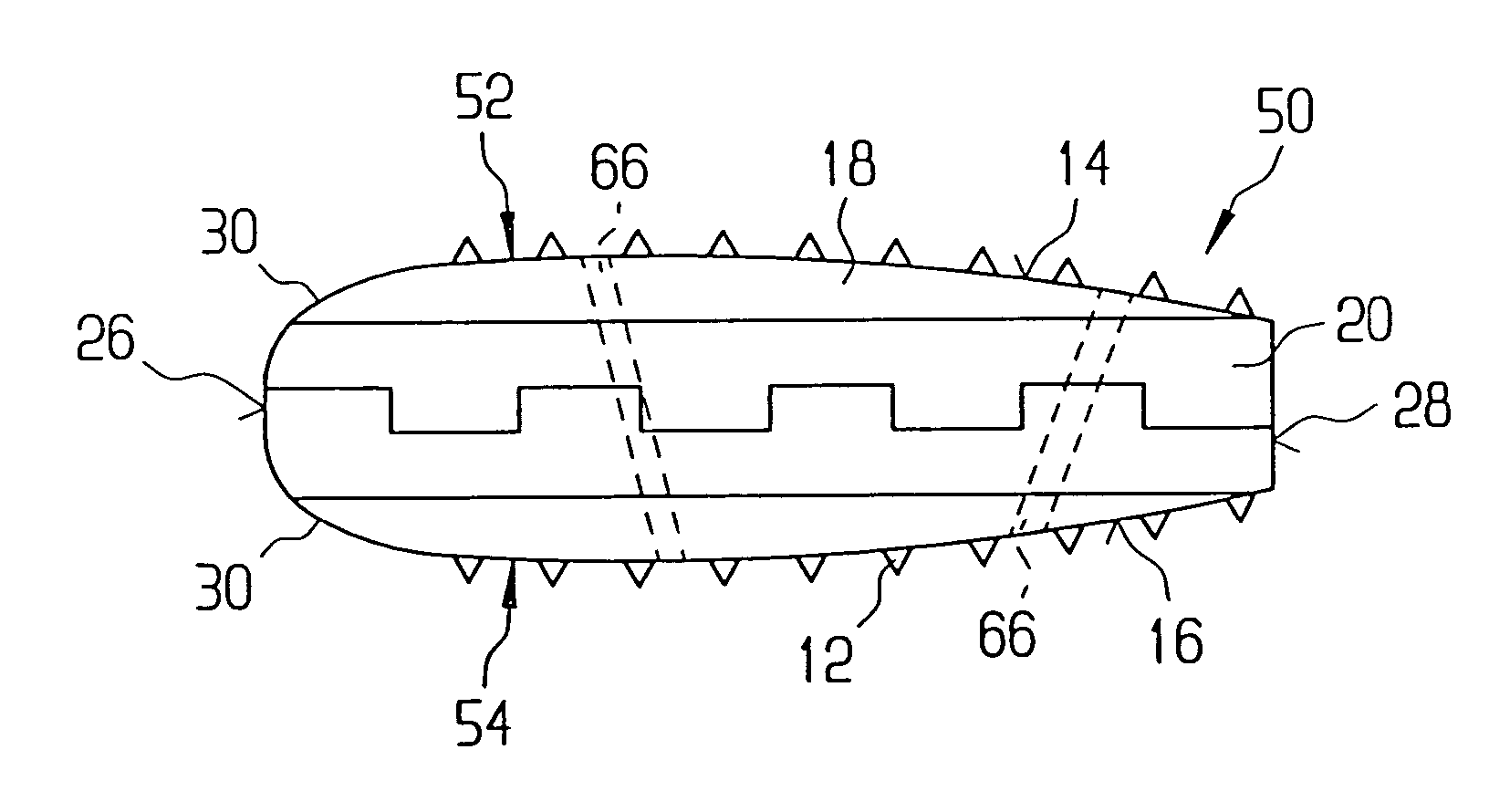 Intervertebral allograft spacer