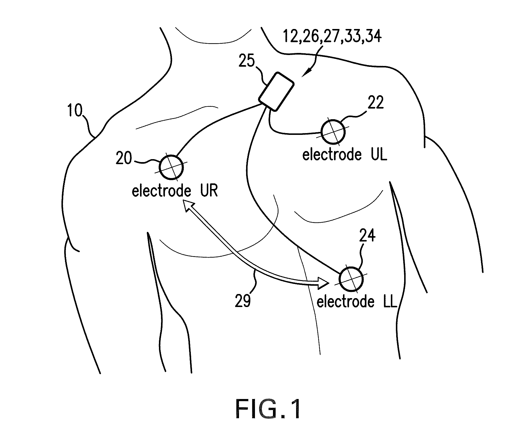 Body-worn monitor for measuring respiratory rate