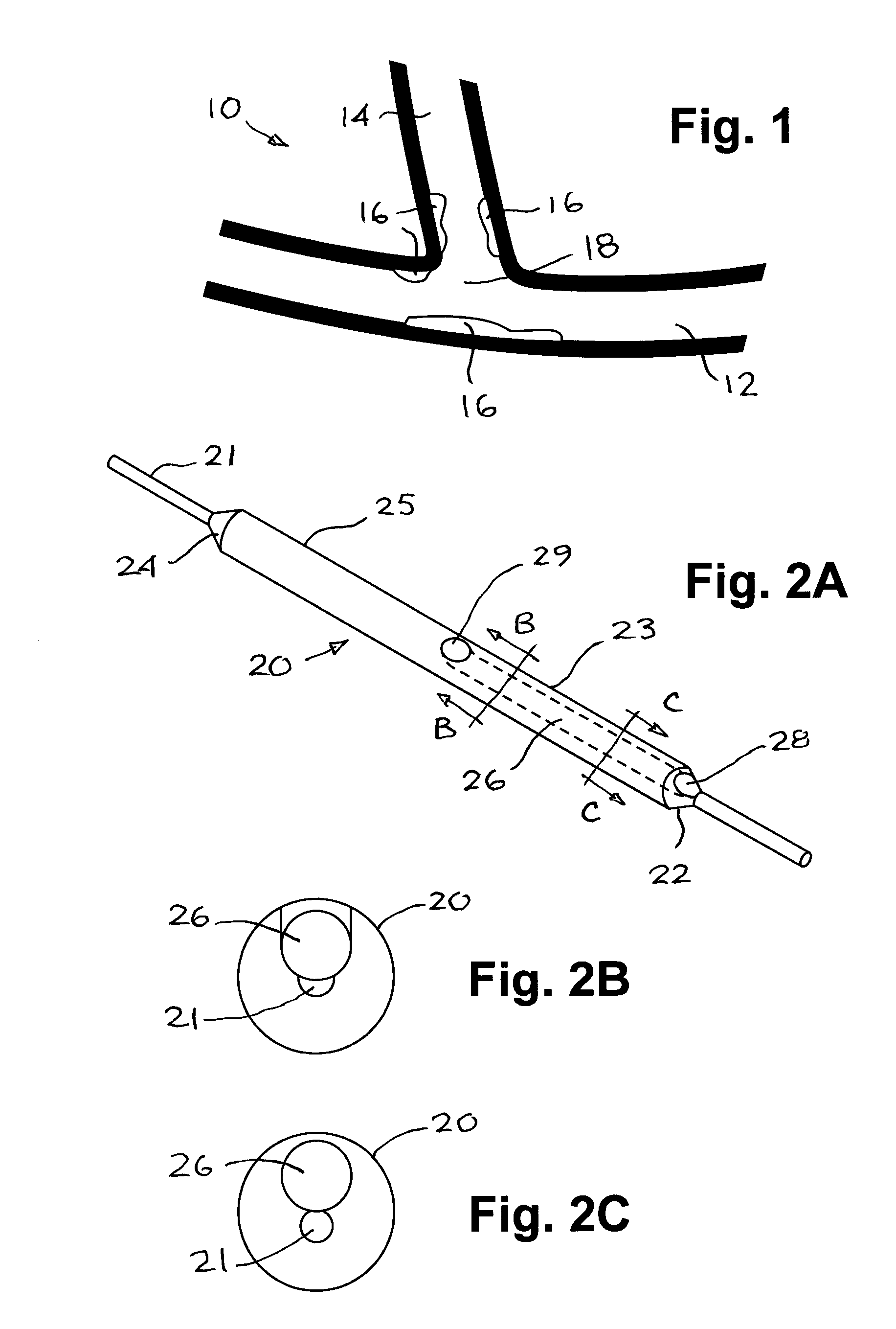 Bifurcated dual-balloon catheter system for bifurcated vessels