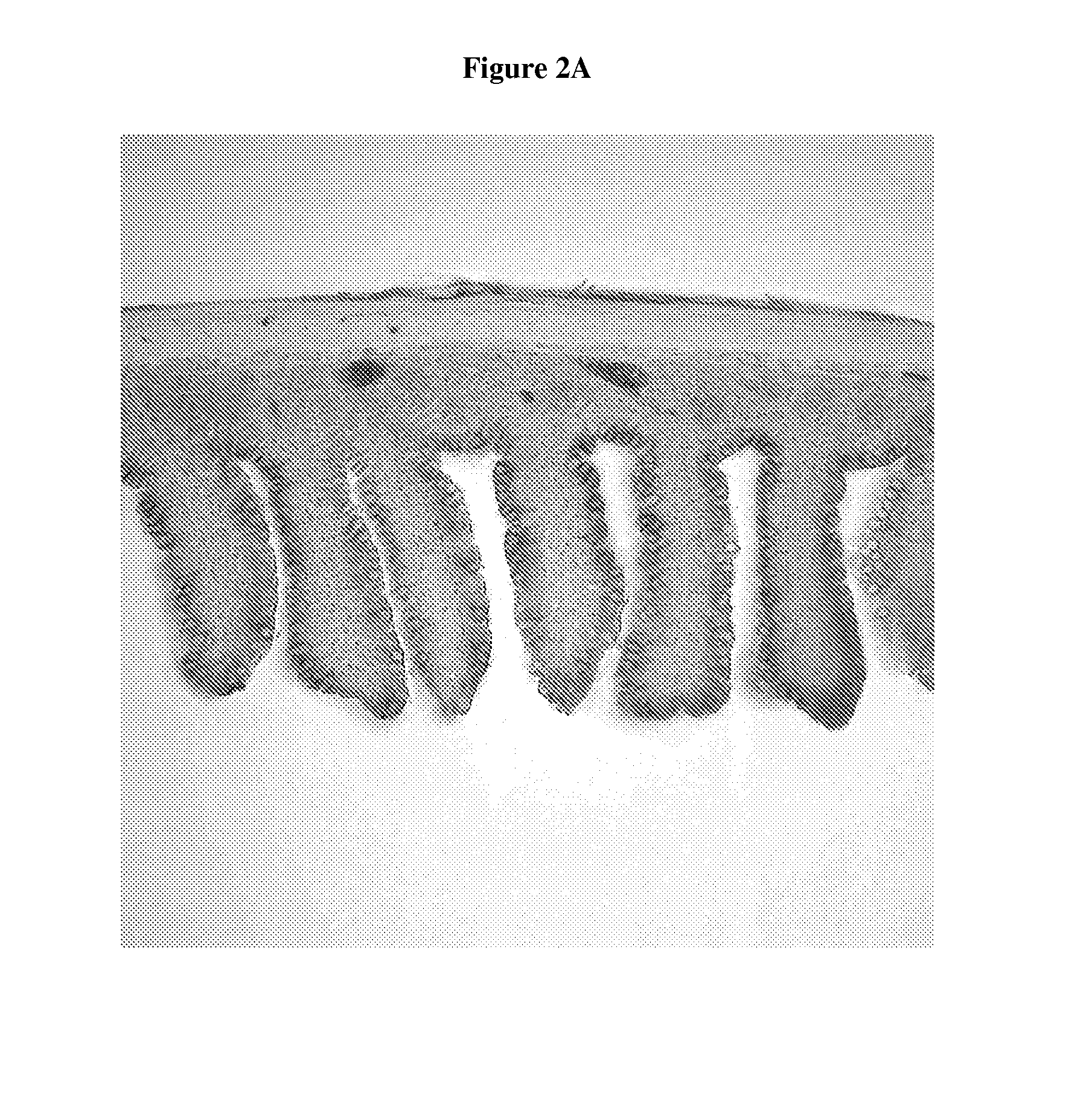 Compositions for the Treatment of Autodigestion