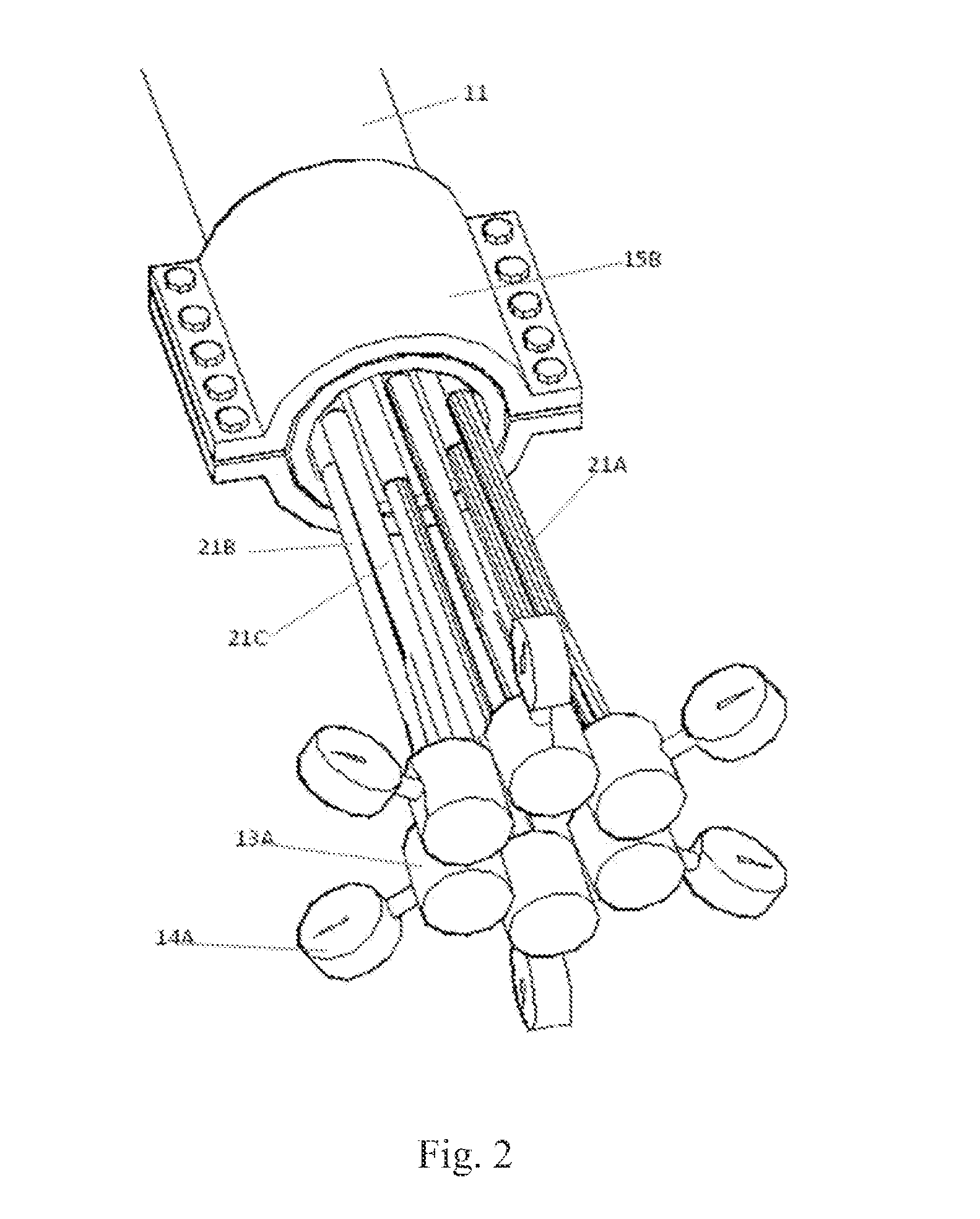 Umbilical buckling testing