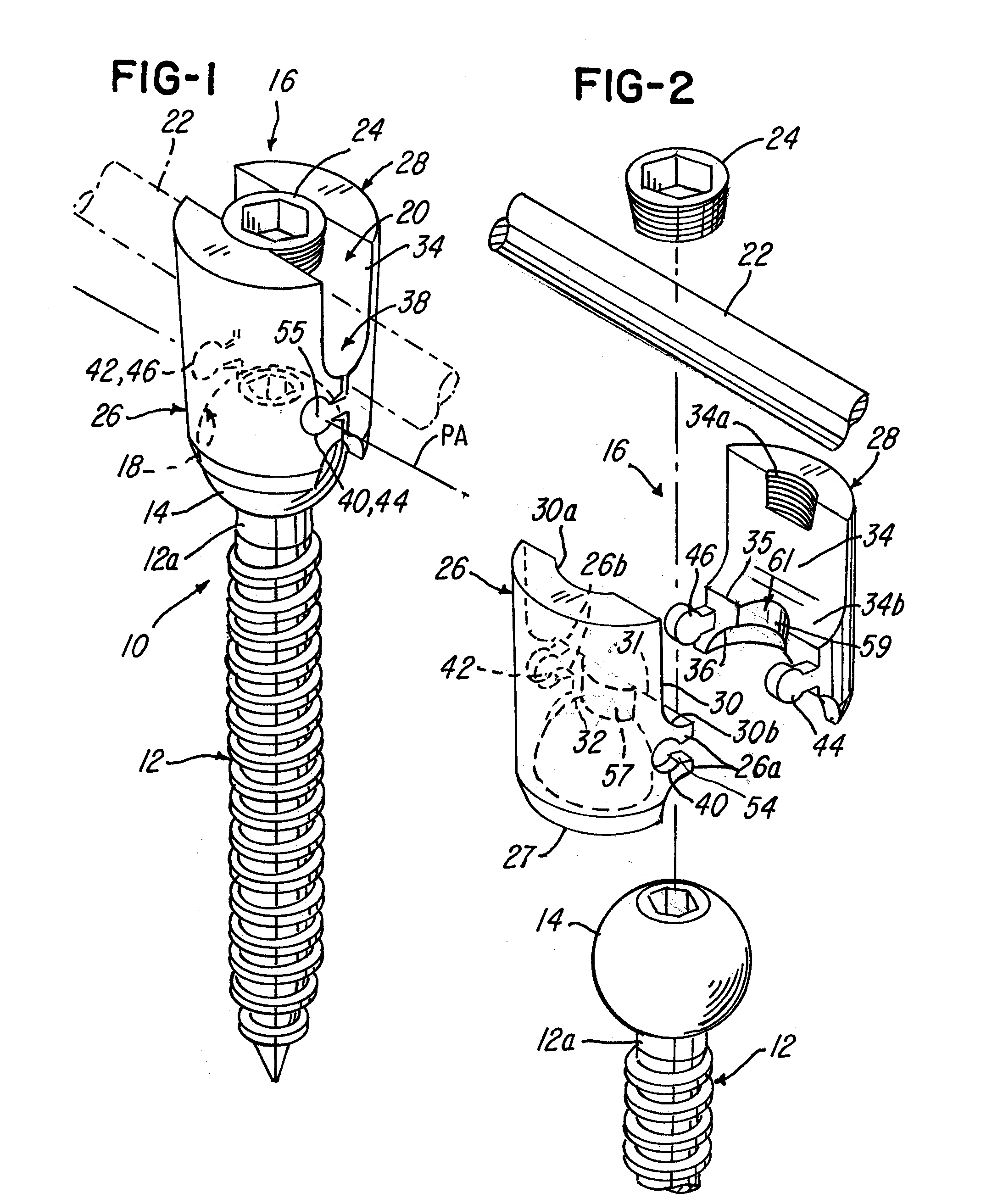 Polyaxial screw system and method having a hinged receiver