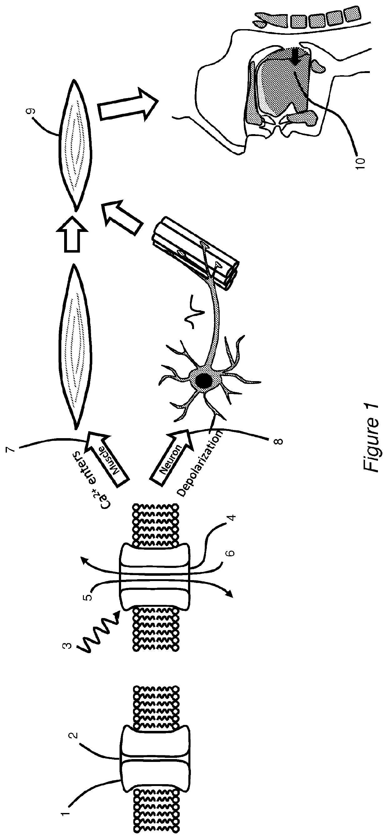 Systems, devices and methods for the treatment of oral and pharyngeal disorders