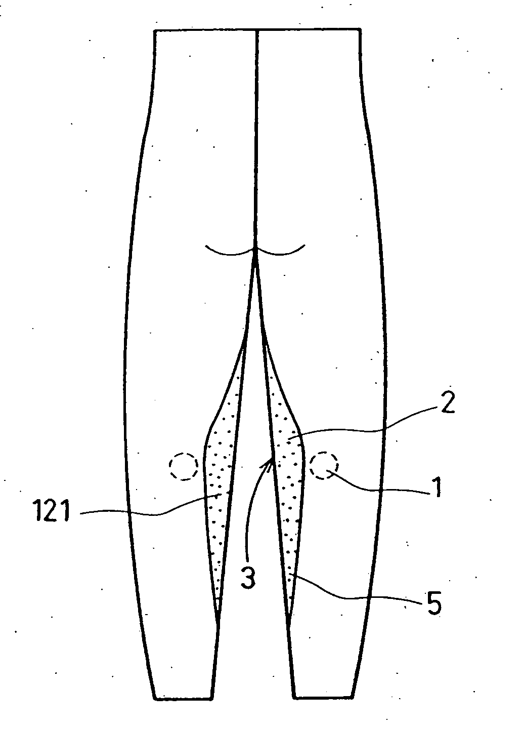 Tights-type leg support garment