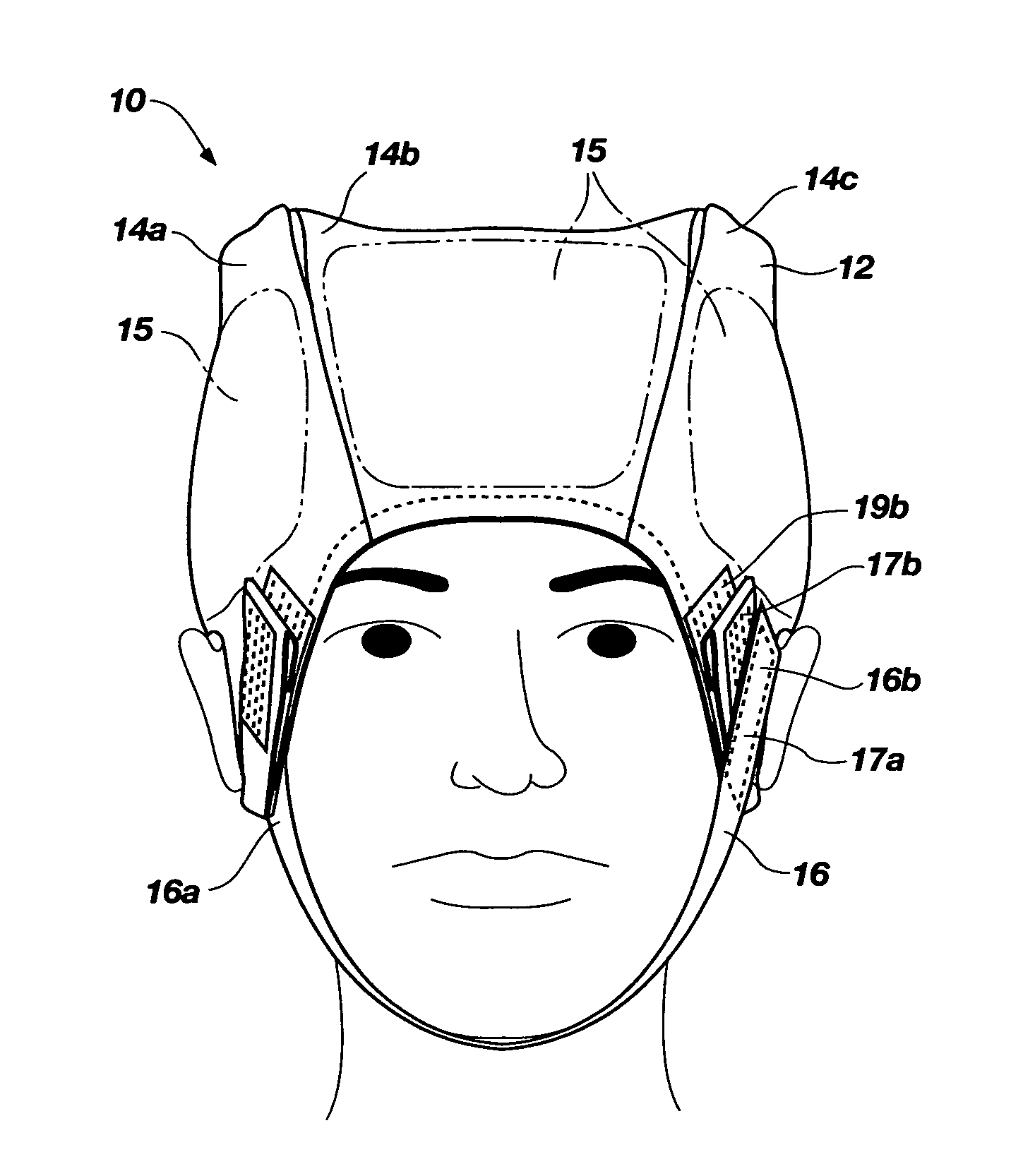 Helmet trauma bandage and method