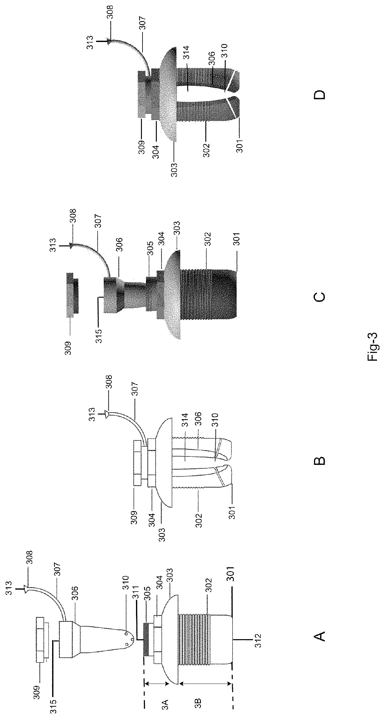 Drug delivery system and method for controlled and continuous delivery of drugs into the brain by bypassing the blood brain barrier