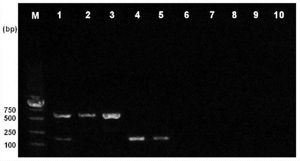 Duplex PCR detection kit and detection method for Listeria monocytogenes and Enterococcus faecium