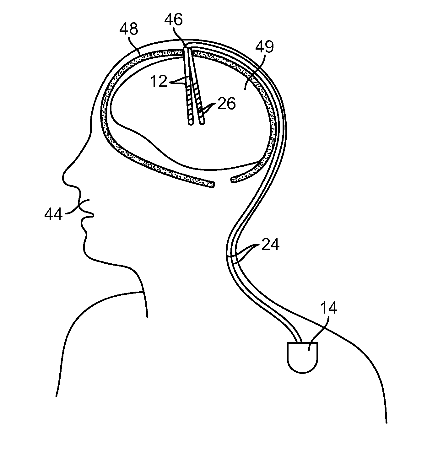 Collection of clinical data for graphical representation and analysis