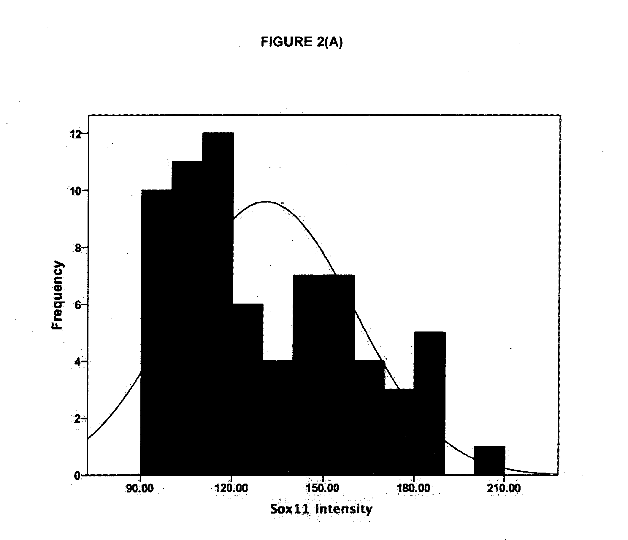 Method of Diagnosing or Prognosing Epithelial Ovarian Cancer