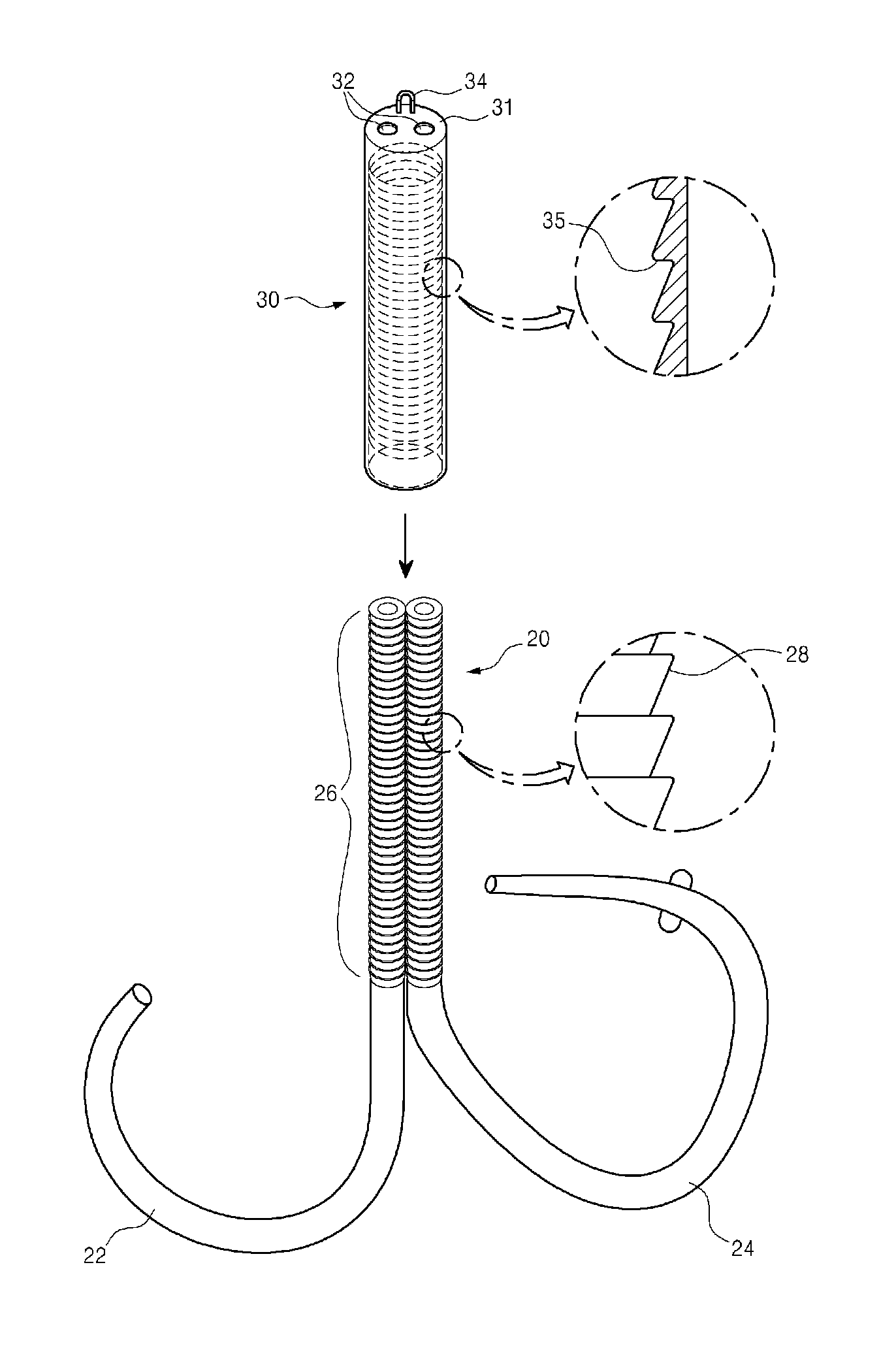 Mitral valve cerclarge annuloplasty appratus and method thereof