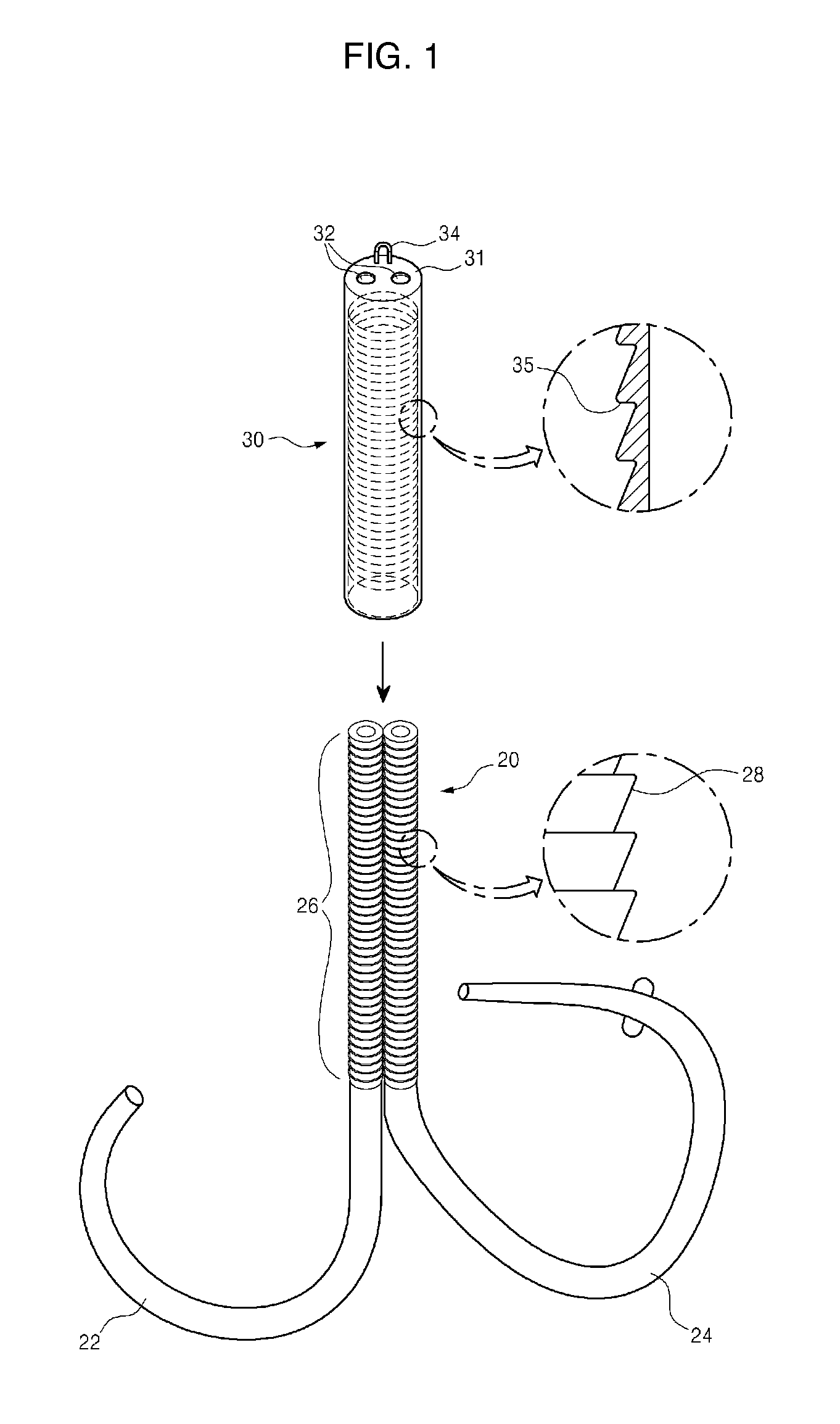 Mitral valve cerclarge annuloplasty appratus and method thereof