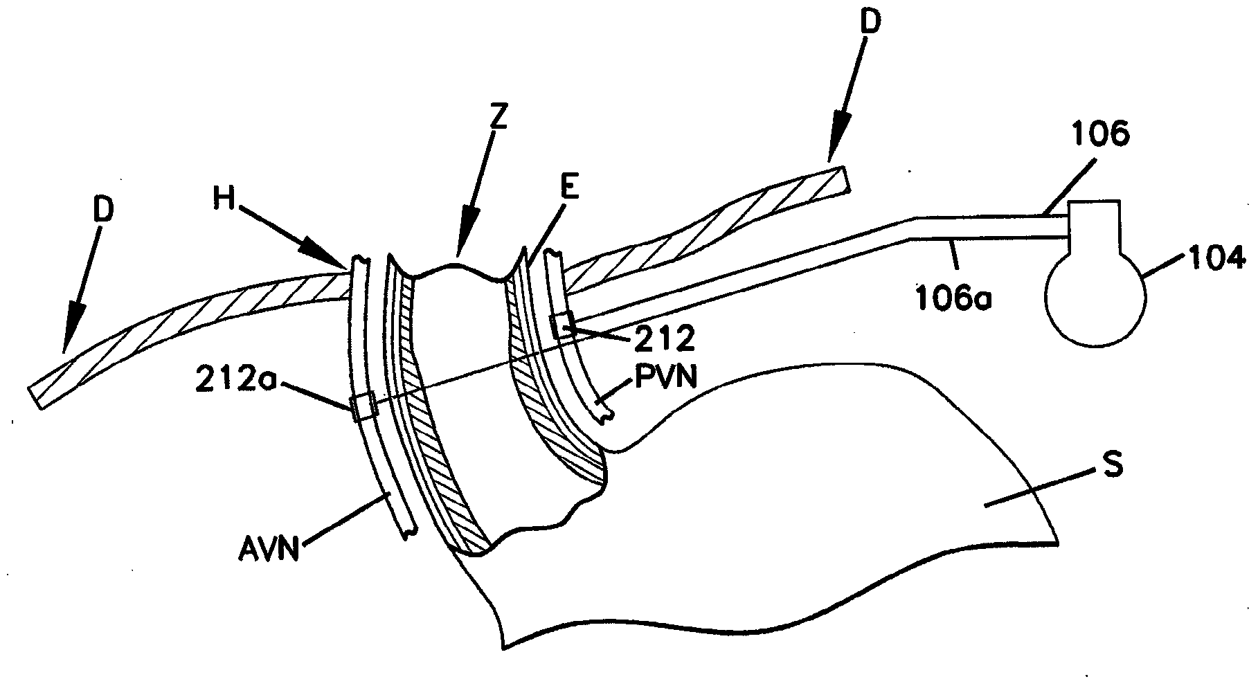 Devices for regulation of blood pressure and heart rate