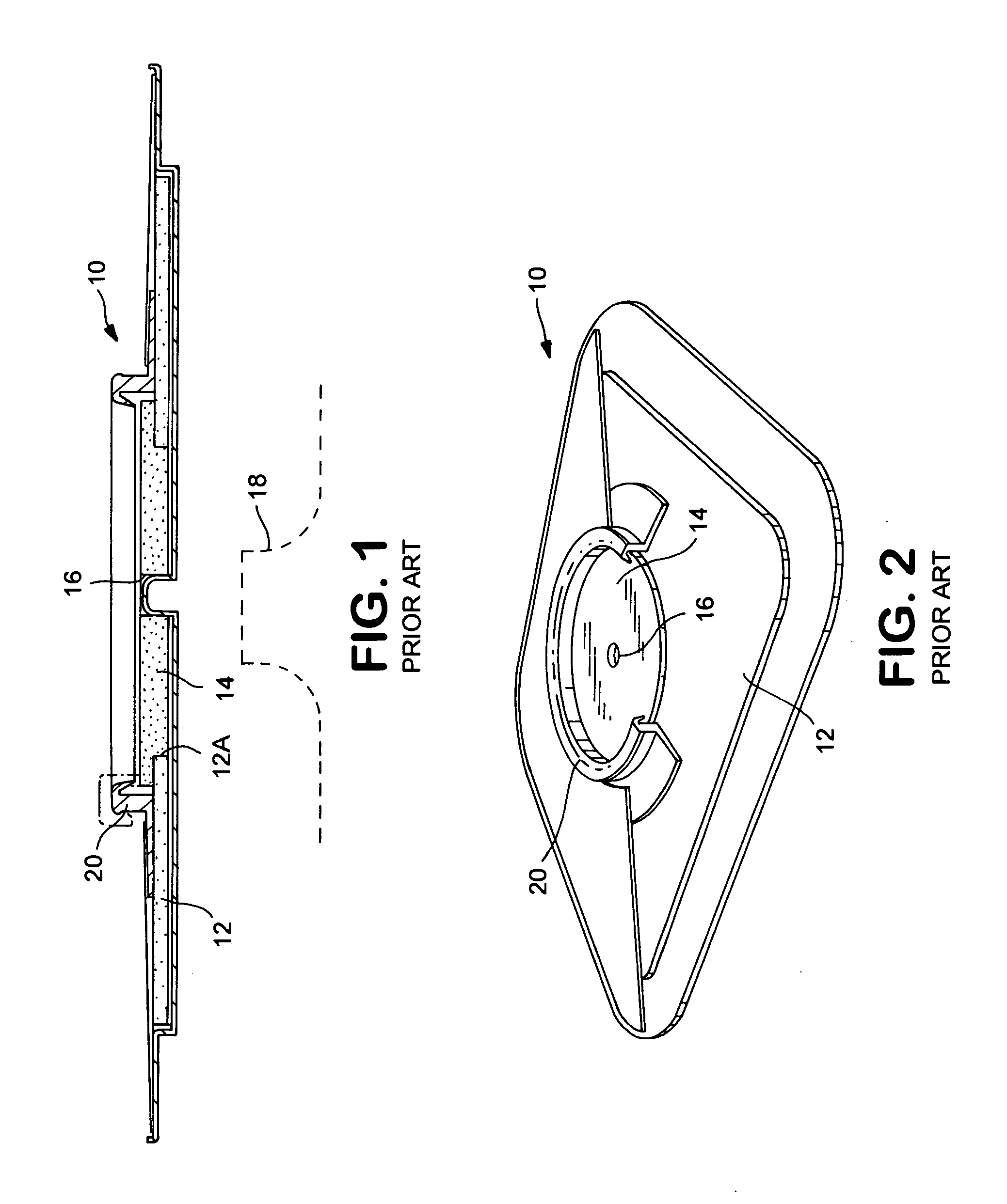 Ostomy appliance