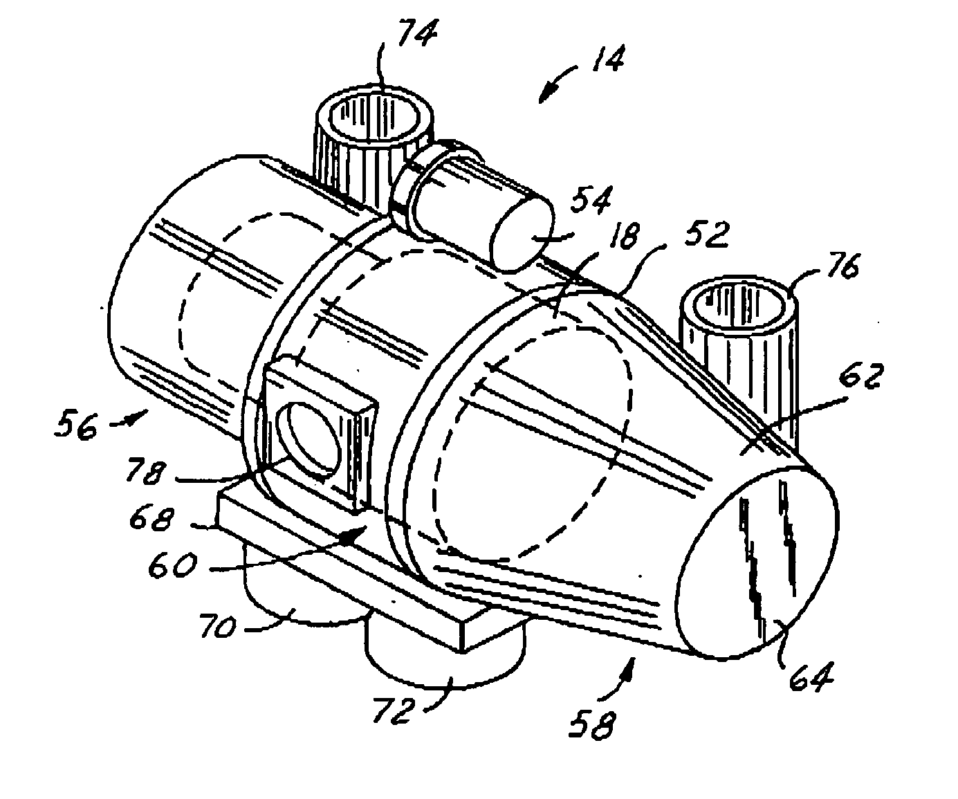 Electron collector system