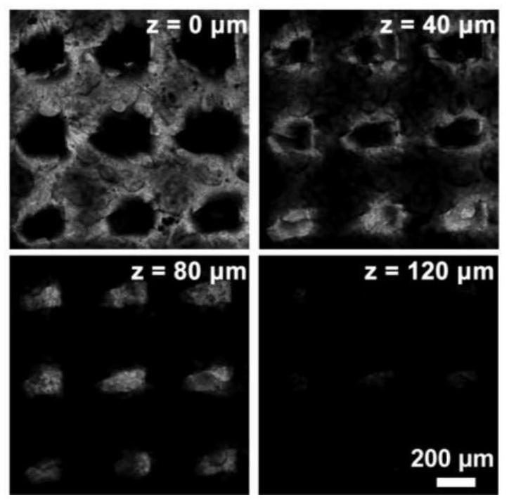 A kind of microneedle capable of extracting skin tissue fluid and its preparation method