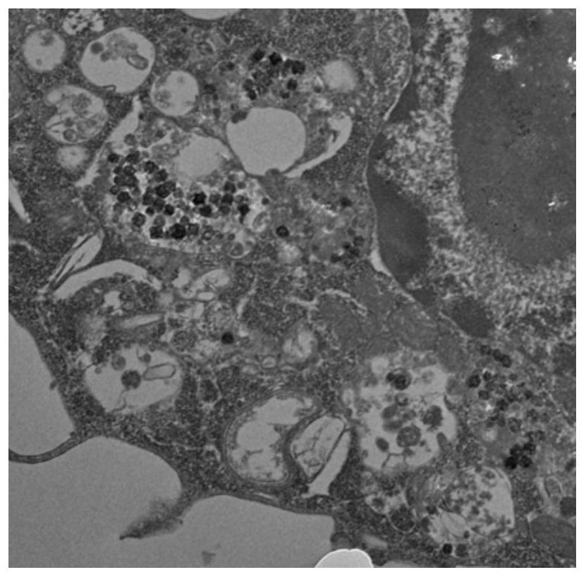 A kind of preparation method of lysosomal membrane coating nanoparticle