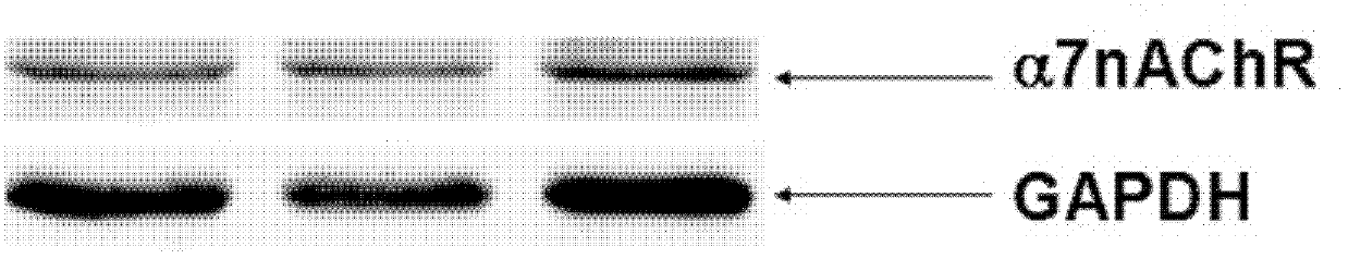 Composition for resisting ischemia reperfusion injury and preparation method and application thereof