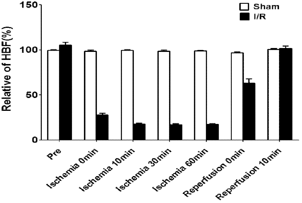 Composition for resisting ischemia reperfusion injury and preparation method and application thereof