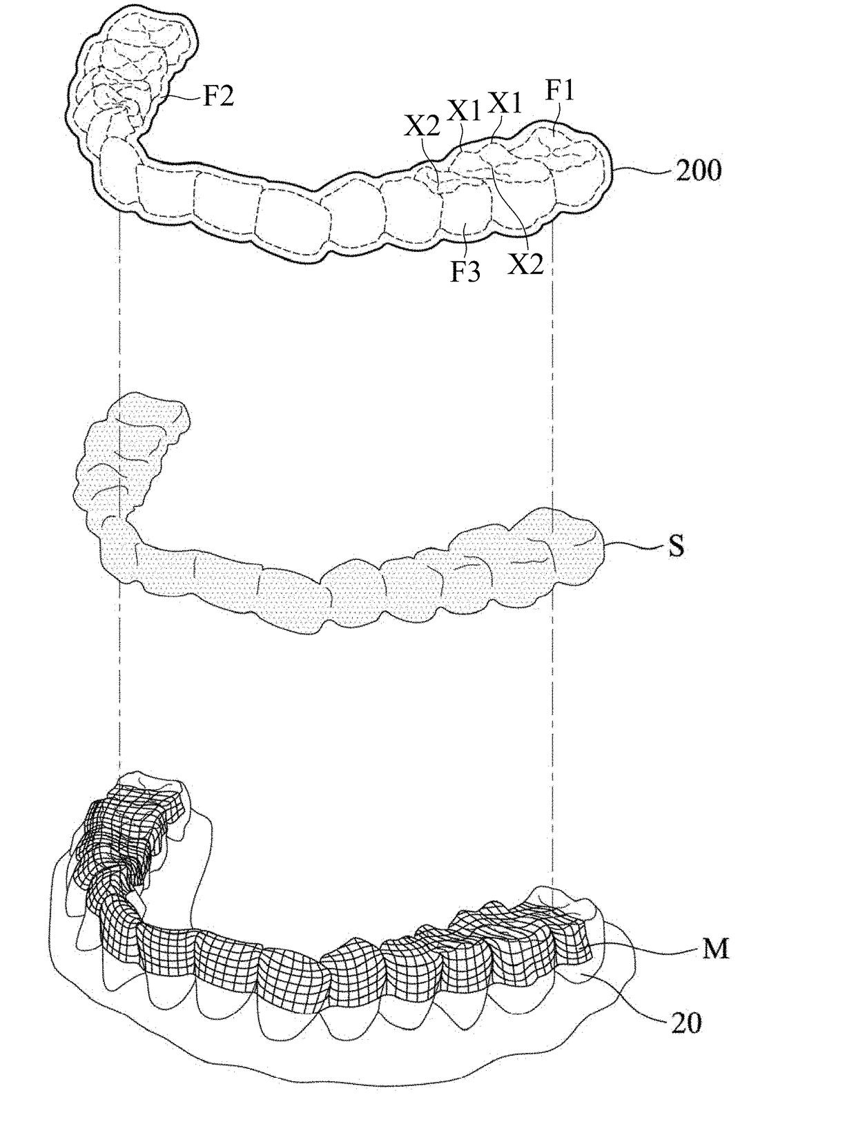 Masticatory orthodontic device