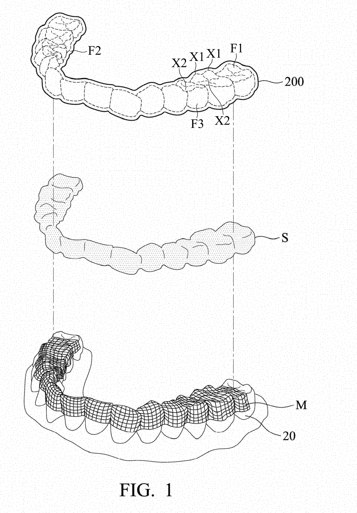 Masticatory orthodontic device