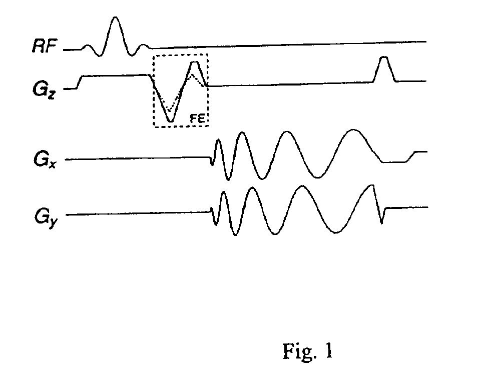 Rapid measurement of time-averaged blood flow using ungated spiral phase-contrast MRI