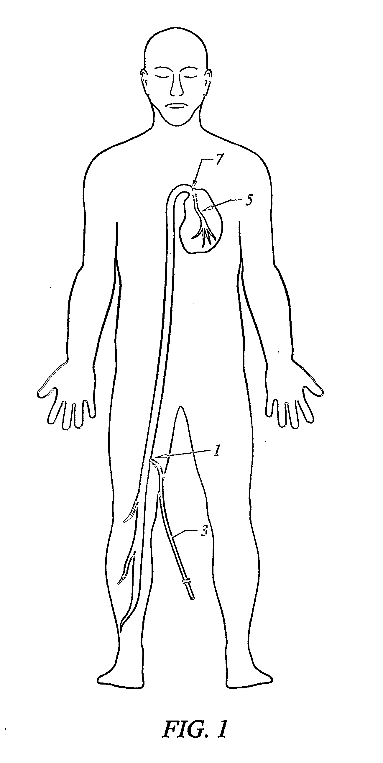 Computer assisted manipulation of catheters and guide wires